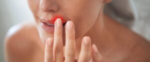 Does ZYN Damage Your Teeth